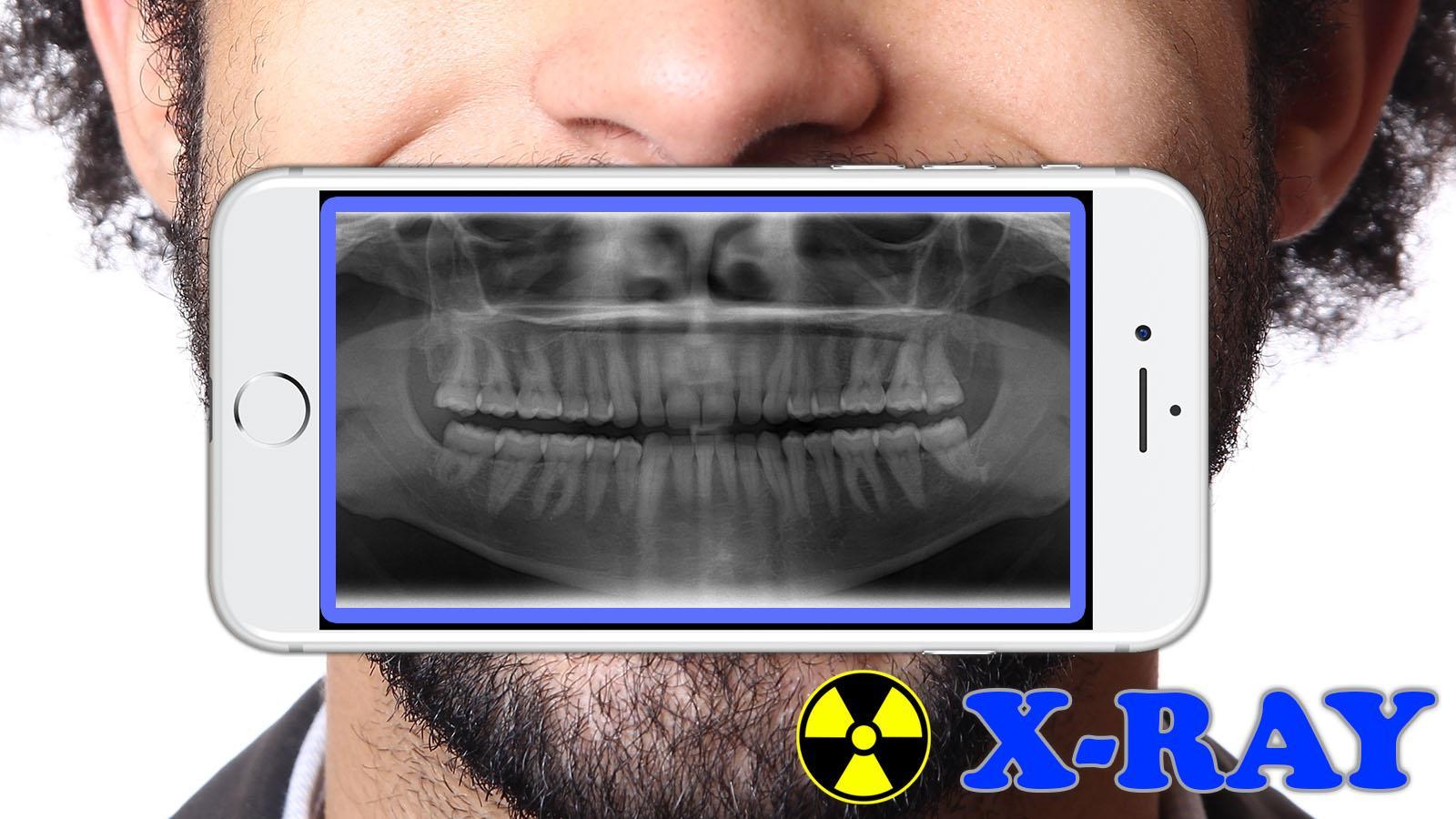 X-Ray Filter Photo 32 Screenshot 2
